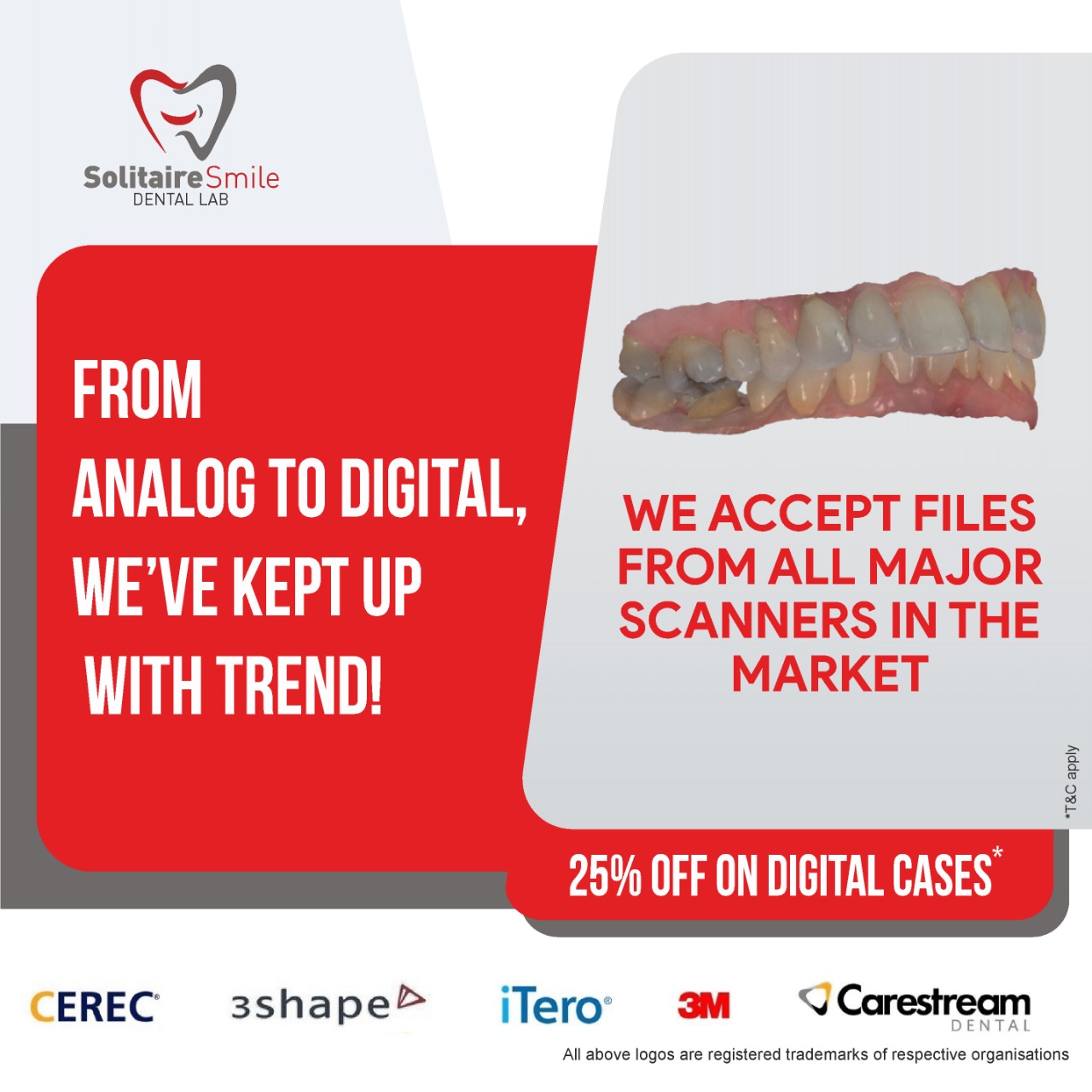 From analog to digital, we've kept up with trend — 25% off on digital cases
